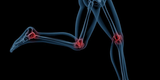 Does Running Harm Your Joints? Truths and Myths About Running and Joint Health